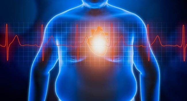 Obesidad y enfermedad cardiovascular.                        El tejido adiposo intravisceral es un claro peligro para la salud.