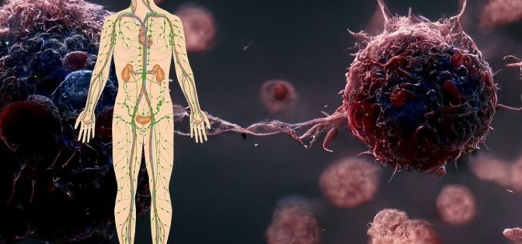 TUMORES NEUROENDOCRINOS