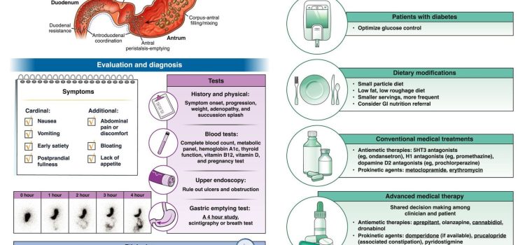 GASTROPARESIA ¿QUÉ ES) GASTROPARESIA