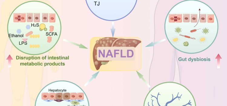 SULFURO DE HIDRÓGENO – EJE INTESTINO-HÍGADO EL PAPEL DEL SULFURO DE HIDRÓGENO H₂S (sulfuro de hidrógeno (H₂S) en el eje intestino-hígado durante la ENFERMEDAD HÍGADO GRASO.