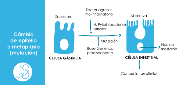 Metaplasia Enteroide