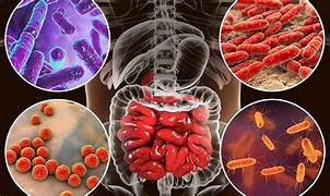 DISBIOSIS INTESTINAL