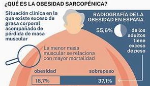 OBESIDAD SARCOPÉNICA