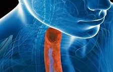 DÍA MUNDIAL DE LA ESOFAGITIS EOSINOFÍLICA – 22/5/26 22 DE MAYO DE 2026 - DÍA MUNDIAL DE LA ESOFAGITIS EOSINOFÍLICA